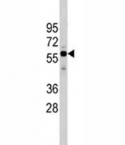 Western blot analysis of Cdc25A antibody and HeLa lysate. Predicted molecular weight: 59-70 kDa.