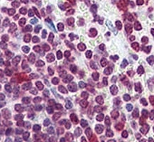 IHC analysis of FFPE human spleen tissue stained with Cdc25A antibody~
