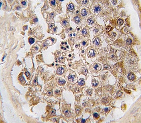 IHC analysis of FFPE human testis tissue stained with mTOR antibody
