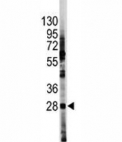 Western blot analysis of HES1 antibody and HL-60 lysate. Predicted molecular weight: 30-35 kDa.