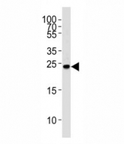 Western blot analysis of lysate from Ramos cell line using GRB2 antibody at 1:1000. Predicted molecular weight ~25kDa.