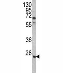 Western blot analysis of GRB2 antibody and A2058 lysate.