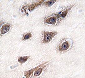 IHC analysis of FFPE human brain tissue stained with GRB2 antibody