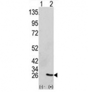 Western blot analysis of GRB2 antibody and 293 cell lysate (2 ug/lane) either nontransfected (Lane 1) or transiently transfected with the GRB2 gene (2). Predicted molecular weight ~25kDa.