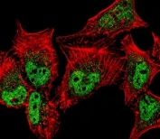Fluorescent confocal image of HeLa cell stained with MEF2C antibody. MEF2C immunoreactivity is localized to vesicles and nucleus significantly.