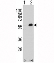Western blot analysis of MEF2C antibody and 293 cell lysate either nontransfected (Lane 1) or transiently transfected with the MEF2C gene (2).