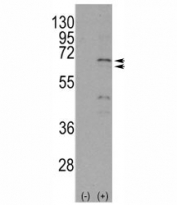 Western blot analysis of NUR77 antibody and 293 cell lysate either nontransfected (Lane 1) or transiently transfected with the NR4A1 gene (2). Predicted molecular weight ~64/66kDa (isoforms 1/2).