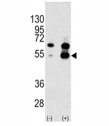 Western blot analysis of VEGFA antibody and 293 cell lysate either nontransfected (Lane 1) or transiently transfected with the VEGFA gene (2). Predicted molecular weight: VEGF1 monomoer ~ 27kDa, homodimer ~54 kDa.
