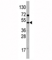 Western blot analysis of VEGFD antibody and 293 lysate. Expected molecular weight: 40-53 kDa (pro-form), ~21 kDa (mature/active form).