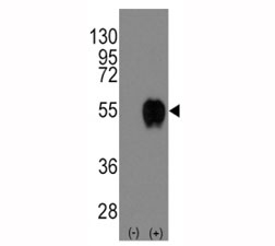 Western blot analysis of CD14 antibody and 293 cell lysate (2 ug/lane) either nontransfected (Lane 1) or transiently transfected with the CD14 gene (2).