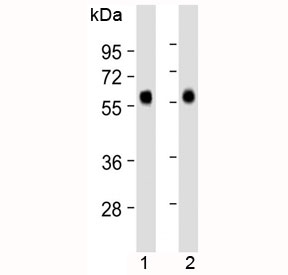 Western blot testing of 1) human liver and 2) human lung lysate with CD14 antibody at 1:2000 dilution. Expected molecular weight: 40-55 kDa depending on glycosylation level.