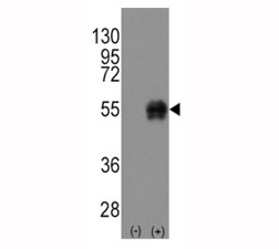 Western blot analysis of CD14 antibody and untransfected/transfected 293 cell lysate