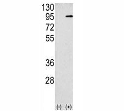 Western blot analysis APP antibody and 293 cell lysate (2 ug/lane) either nontransfected (Lane 1) or transiently transfected with the APP gene (2).