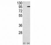 Western blot analysis APP antibody and 293 cell lysate (2 ug/lane) either nontransfected (Lane 1) or transiently transfected with the APP gene (2). Predicted molecular weight 79~120 kDa depending on glycosylation level.