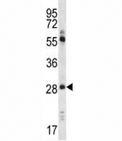 Claudin 1 antibody western blot analysis in A549 lysate