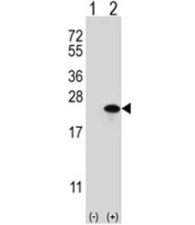 Western blot analysis of Claudin 1 antibody and 293 cell lysate either nontransfected (Lane 1) or transiently transfected (2) with the CLDN1 gene.~