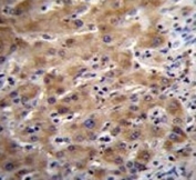 Glypican 3 antibody immunohistochemistry analysis in formalin fixed and paraffin embedded human liver tissue.