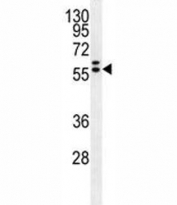 Glypican 3 antibody western blot analysis in HepG2 lysate