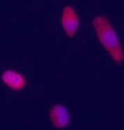 Immunofluorecence staining of Glypican 3 antibody on HepG2 cells. The cells were acetone fixated. Ab dilution of 1:50. Original magnification 1:400. (Courtesy of Dr. Mariana Dabeva, Department of Medicine, Albert Einstein College of Medicine)