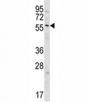 GPC3 antibody western blot analysis in Jurkat lysate