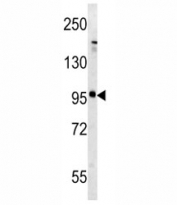 Western blot analysis of mGLUR5 antibody and mouse brain tissue lysate