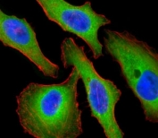 Fluorescent confocal image of HeLa cells stained with Tuberin antibody. Alexa Fluor 488 secondary (green) was used. Tuberin/TSC2 immunoreactivity is localized to the cytoplasm.