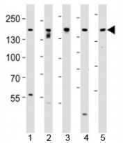 Western blot analysis of lysate from SH-SY5Y, MCF-7, PC3, LNCaP, HeLa, cell line (left to right) using Tuberin antibody at 1:1000 for each lane.