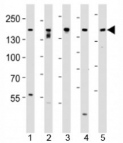 Western blot analysis of lysate from SH-SY5Y, MCF-7, PC3, LNCaP, HeLa, cell line (left to right) using Tuberin antibody at 1:1000 for each lane.