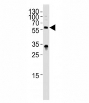 Western blot analysis of lysate from HepG2 cell line using IL1R1 antibody diluted at 1:1000. Predicted molecular weight 60-65 kDa.