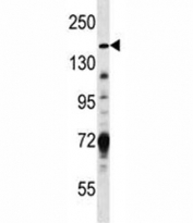 Hamartin antibody western blot analysis in MDA-MB231 lysate. Predicted molecular weight: 130~150kDa.
