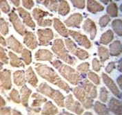 Hamartin antibody immunohistochemistry analysis in formalin fixed and paraffin embedded human skeletal muscle.