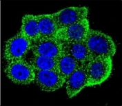 Confocal immunofluorescent analysis of Hamartin antibody with HeLa cells followed by Alexa Fluor 488-conjugated goat anti-rabbit lgG (green). DAPI was used as a nuclear counterstain (blue).