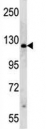 PARP antibody western blot analysis in HeLa lysate