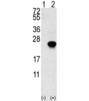 Western blot analysis of FGF1 antibody and 293 cell lysate (2 ug/lane) either nontransfected (Lane 1) or transiently transfected with the FGF1 gene (2).