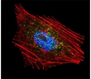 Confocal immunofluorescent analysis of Parkin antibody with NCI-H460 cells followed by Alexa Fluor 488-conjugated goat anti-rabbit lgG (green). Actin filaments have been labeled with Alexa Fluor 555 Phalloidin (red). DAPI was used as a nuclear counterstain (blue).