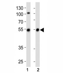 Western blot analysis of lysate from (1) SH-SY5Y cell line and (2) human brain tissue lysate using Parkin antibody at 1:1000. Predicted molecular weight: 50-60 kDa.
