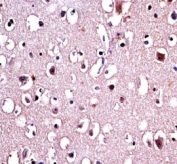 Parkin antibody immunohistochemistry analysis in formalin fixed and paraffin embedded human brain tissue.