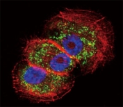 Confocal immunofluorescent analysis of Parkin antibody with NCI-H460 cells followed by Alexa Fluor 488-conjugated goat anti-rabbit lgG (green). Actin filaments have been labeled with Alexa Fluor 555 Phalloidin (red). DAPI was used as a nuclear counterstain (blue).