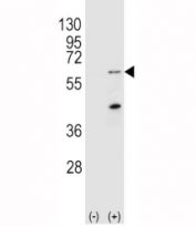 Western blot analysis of PINK1 antibody and 293 cell lysate (2 ug/lane) either nontransfected (Lane 1) or transiently transfected (2) with the Park6/PINK1 gene.