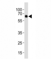 Western blot analysis of lysate from human placenta tissue, using Park6/ PINK1 antibody diluted at 1:1000. Predicted molecular weight: 60-70 kDa