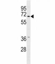 PINK antibody western blot analysis in A549 lysate. Predicted molecular weight: 60-70 kDa