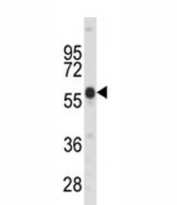 Western blot analysis of PINK1 antibody and mouse kidney tissue lysate. Predicted molecular weight: 60-70 kDa