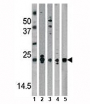 Western blot analysis of DJ-1 antibody and mouse 1) brain, 2) kidney, 3) liver tissue lysate, 4) NIH3T3, and 5) human HeLa lysate. Predicted molecular weight ~20 kDa.