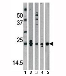 Western blot analysis of DJ-1 antibody and mouse