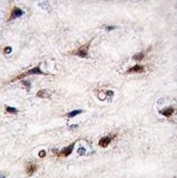 IHC analysis of FFPE human brain tissue stained with NURR1 antibody