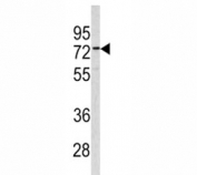 Western blot analysis of CEA antibody and 293 lysate. Expected molecular weight: 80~200 kDa depending on glycosylation level.