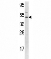 Western blot analysis of FLI1 antibody and 293 lysate.