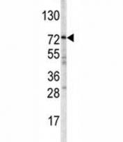 Western blot analysis of ABCG1 antibody and mouse spleen tissue lysate. Predicted molecular weight: 75~90 kDa.