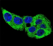 Confocal immunofluorescent analysis of g-Actin antibody with HepG2 cells followed by Alexa Fluor 488-conjugated goat anti-rabbit lgG (green). DAPI was used as a nuclear counterstain (blue).