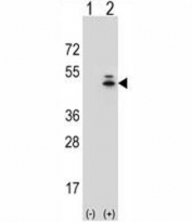 Western blot analysis of g-Actin antibody and 293 cell lysate (2 ug/lane) either nontransfected (Lane 1) or transiently transfected (2) with the ACTG1 gene.